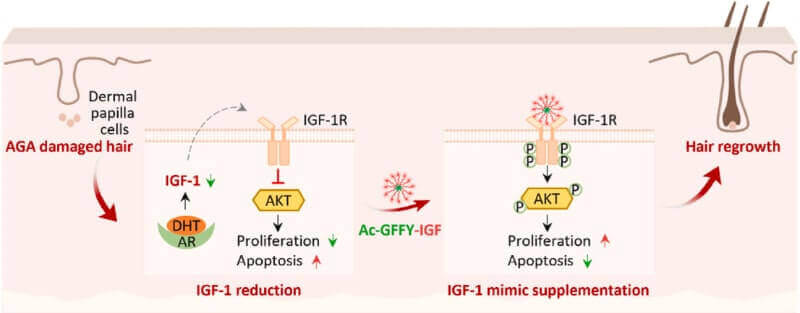 IGF-1 Hair Growth