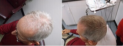Hemp extract (with cannabidiol) hair growth.