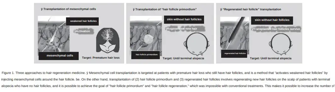 Bioengineering Approaches to Hair Regeneration