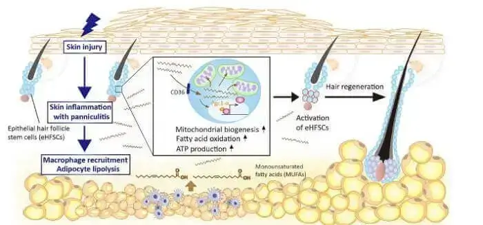 Skin Injury Adipocytes Fatty Acids Hair Growth